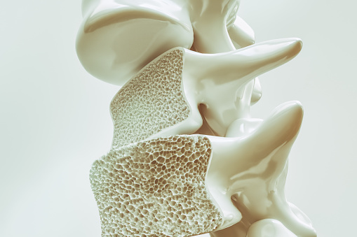 Osteoporóza obratlů